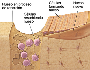 Diagrama del crecimiento normal de un hueso que muestra tres tipos diferentes de células óseas.