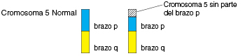 La imagen muestra un cromosoma normal con el brazo P y el brazo Q, en comparación con un cromosoma que no tiene parte del brazo P.