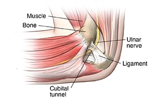 Inside view of elbow showing forearm muscles, bone, ligament, and ulnar nerve in cubital tunnel.
